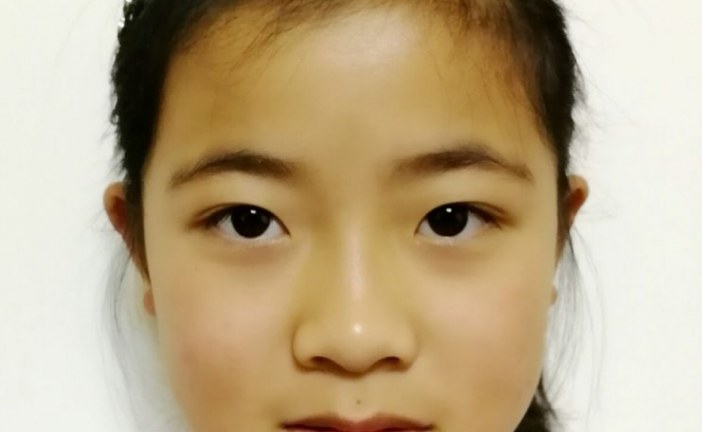 插画-盛夏的翠湖-王雨辰-国际青少年美术家_少美联赛